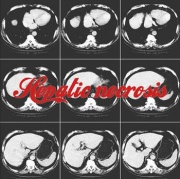 Hepaticnecrosis(splitalbum).jpg
